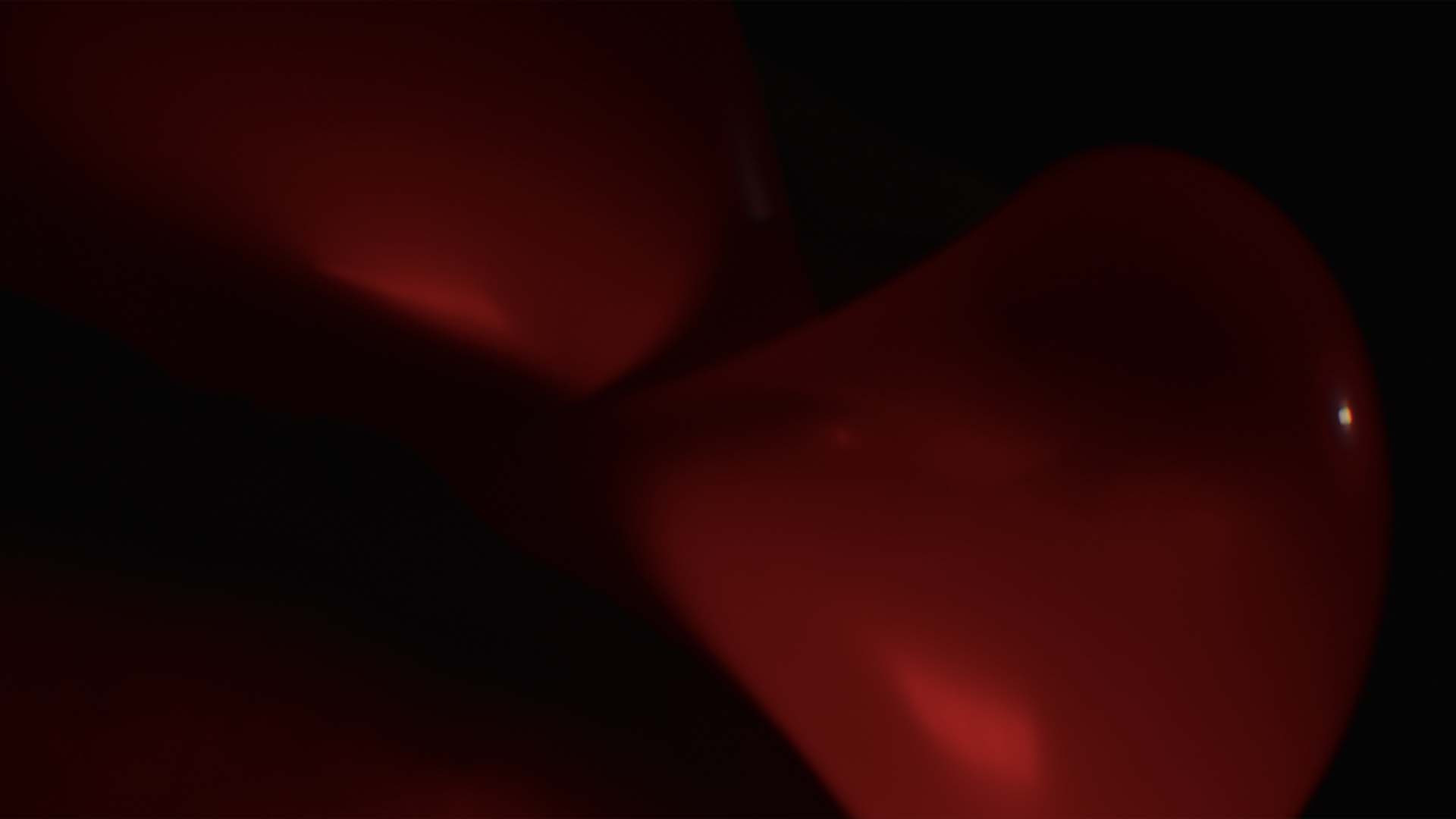 R52.9 Pain, unspecified